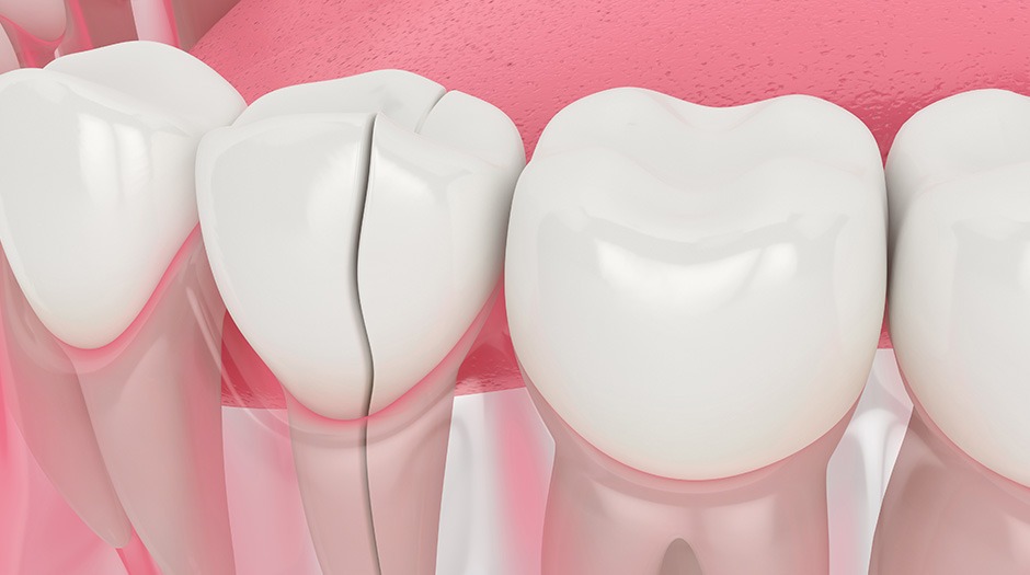 Emergency Dentistry | Lume Dental | General & Family Dentist | Red Deer