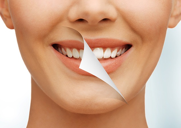Teeth Whitening | Lume Dental | General & Family Dentist | Red Deer