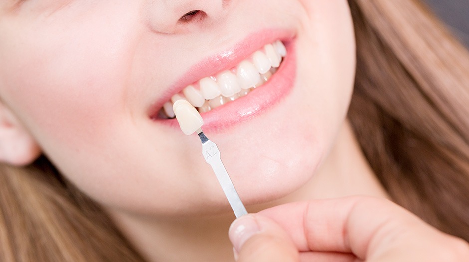 Dental Implants | Lume Dental | General & Family Dentist | Red Deer